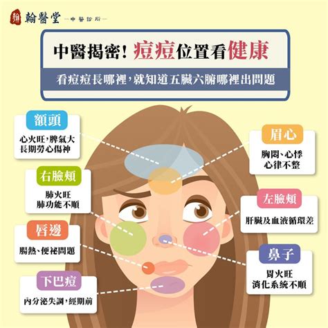 臉上痘痘位置|狂冒痘痘很惱人？臉部10大「常見冒痘」位置全解析，。